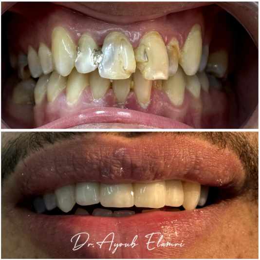 result-image (1)