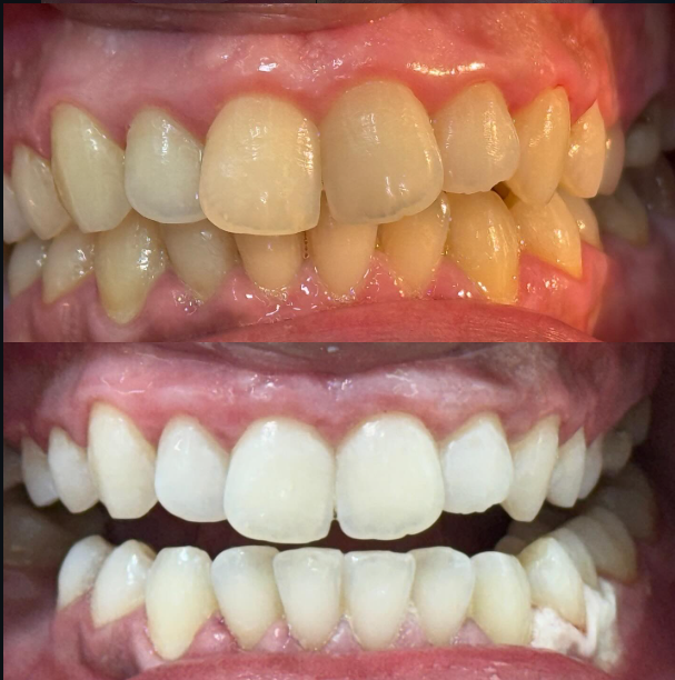 result-image (10)